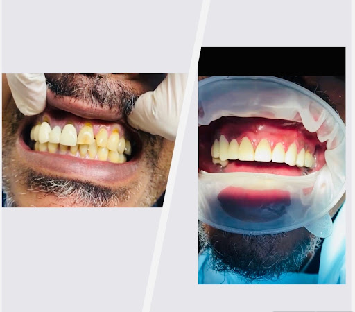 New Smile Dental image
