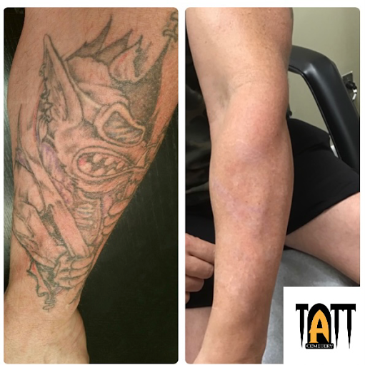 Explore tattoo ideas for someone who passed away, creative tattoo ideas in Fort Myers, available at Laser Tattoo Removal by Tatt Cemetery