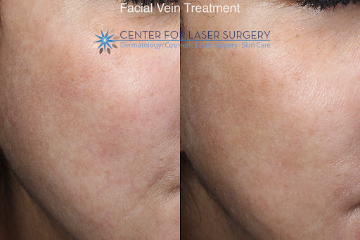 Explore bmw tattoo ideas, creative tattoo ideas in Washington, available at Center For Laser Surgery