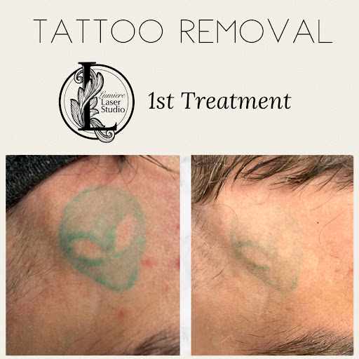 Explore supernatural tattoo ideas, creative tattoo ideas in Ballwin, available at Lumiere Laser Studio