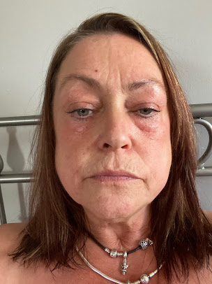 Ace Beauty Clinic - Ace Beauty Clinic