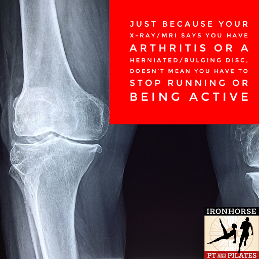 Ironhorse Physical Therapy & Pilates image