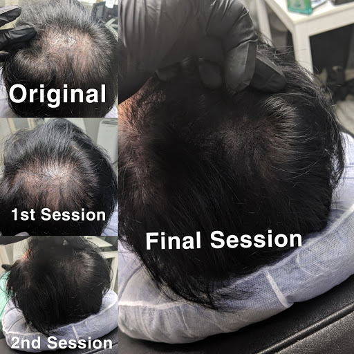 Find tattoo ideas with letters for your next unique tattoo in Roseville at NuHair Ink. Scalp MicroPigmentation & Aesthetic Clinic of Sacramento