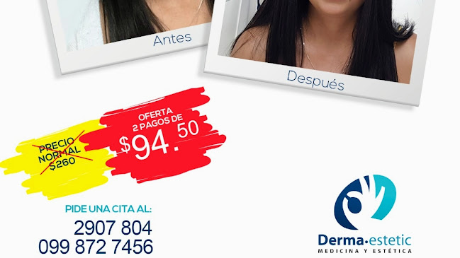 Derma Estetic - Clínica Láser - Quito - Dermatólogo