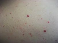 Hair Free Skin - Dallas Electrolysis & School - Photo 4 - Car repair in Dallas, TX, Dallas