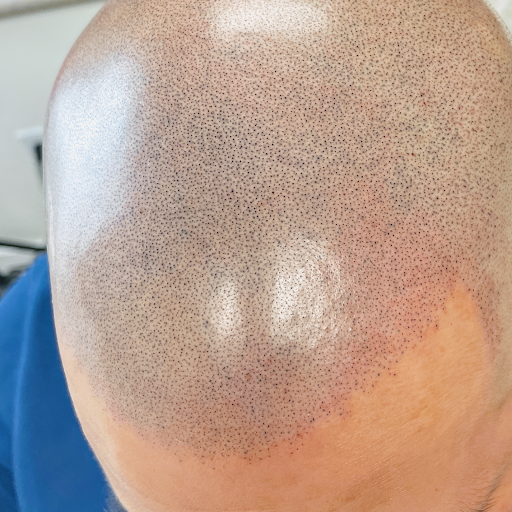 SMP Hair Clinic The Queen Of Scalp image