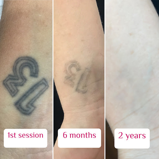 Explore heavenly tattoo ideas, creative tattoo ideas in Ambler, available at Strella Medical Aesthetics