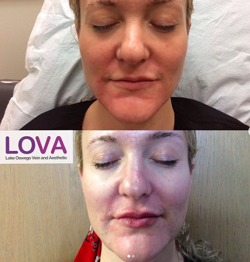 Explore date tattoo ideas men, creative tattoo ideas in Lake Oswego, available at Lake Oswego Vein and Aesthetic LOVA