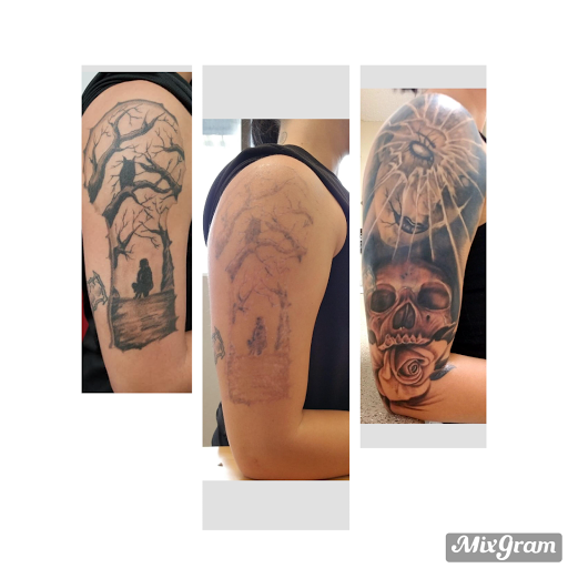 Explore female big tattoo ideas, creative tattoo ideas in Tyler, available at Vanish Laser Aesthetics