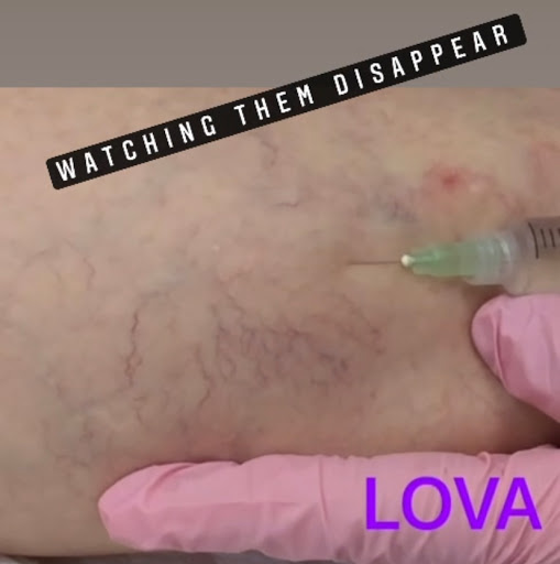 Find boyfriend name tattoo under breast ideas for your next unique tattoo in Lake Oswego at Lake Oswego Vein and Aesthetic LOVA