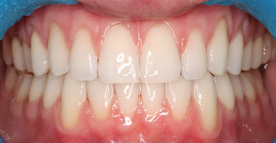 Dr GUILLERMIN Anthony Louis - ORTHODONTIE- Pratique réservée à l'orthodontie à Antony