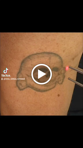 Explore divergent tattoo ideas, creative tattoo ideas in Reno, available at Reno Tattoo Removal