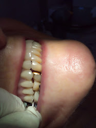 clinica dental caribe