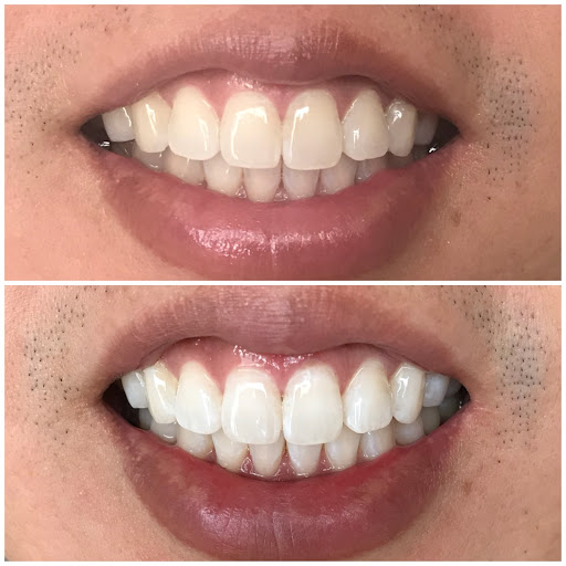 231 N Indian Hill Blvd b, Claremont, CA 91711, USA