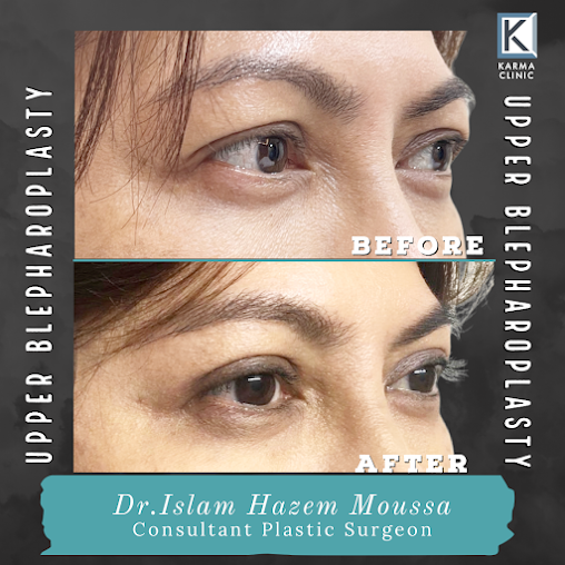 Dr. Hazem Mokhaimer - Dr. Hazem Mokhaimer