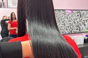 Michelle Beauty Hair - Cirugia Capilar image