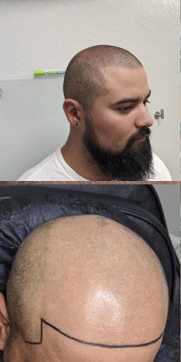 Explore be still and know tattoo ideas, creative tattoo ideas in Roseville, available at NuHair Ink. Scalp MicroPigmentation & Aesthetic Clinic of Sacramento