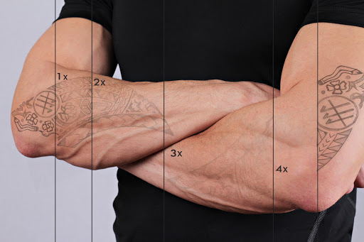 Explore arch angel tattoo ideas, creative tattoo ideas in Denver, available at LaserAll