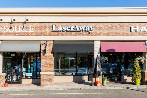 Explore angel neck tattoo ideas, creative tattoo ideas in Scarsdale, available at LaserAway