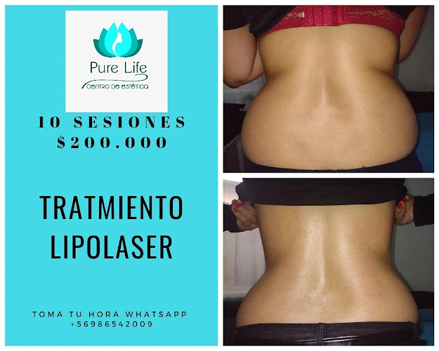 Pure Life Centro De Estetica - Centro de estética