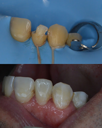 Comentarios y opiniones de Centro Dental Prop Dent