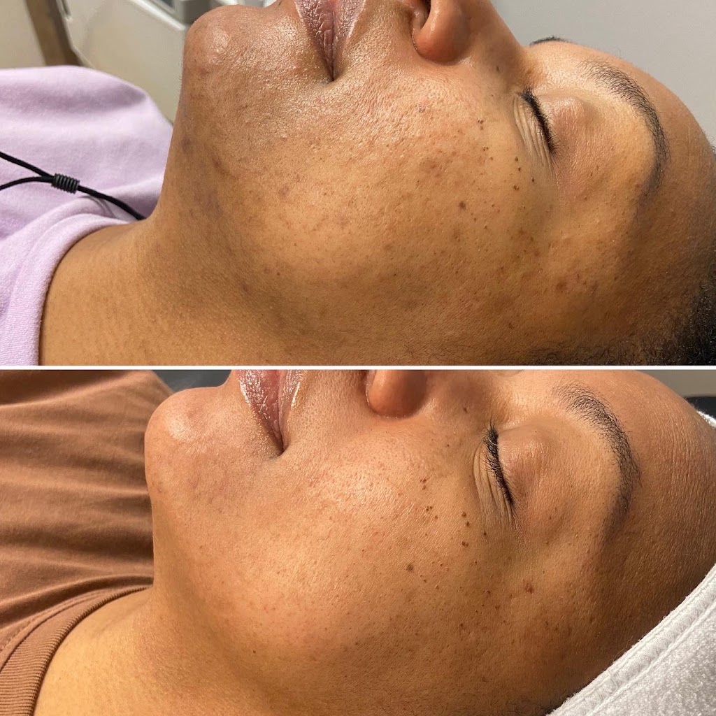 Advanced Skin Care Solutions LLC 30092