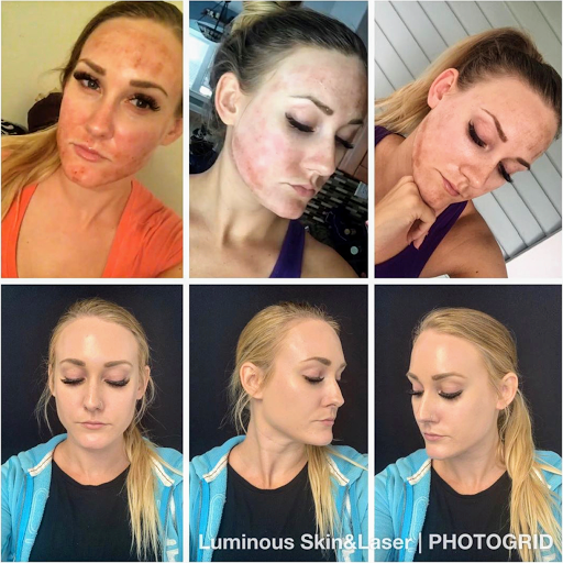 Find minotaur tattoo ideas for your next unique tattoo in Tampa at Luminous Skin and Laser