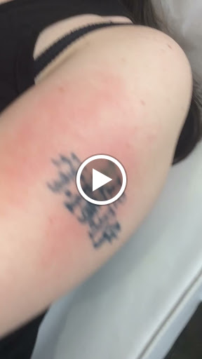 Explore baymax tattoo ideas, creative tattoo ideas in Naples, available at Laser Tattoo Removal Services