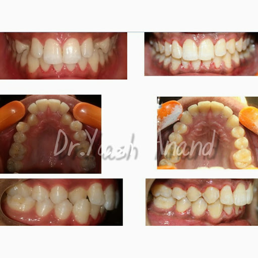 Yash Dental And Orthodontic Centre - Best Orthodontist In Vikaspuri Delhi