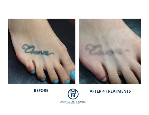 Explore calf tattoo ideas for women, creative tattoo ideas in San Diego, available at Removery Tattoo Removal & Fading