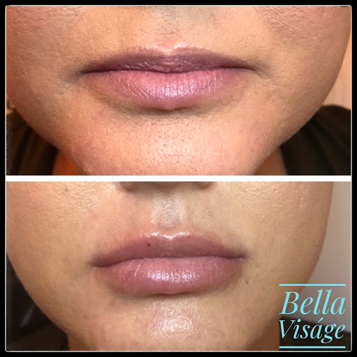 Explore chef tattoo ideas, creative tattoo ideas in Lakeland, available at Bella Visge Medical & Aesthetic Rejuvenation