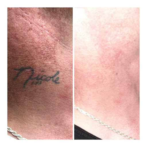 Find forearm tattoo ideas for your next unique tattoo in Longview at Vanish Laser Aesthetics