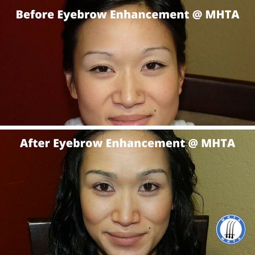 Hair Replacement Service «Medical Hair Transplant & Aesthetics», reviews and photos, 490 Post St #1701, San Francisco, CA 94102, USA