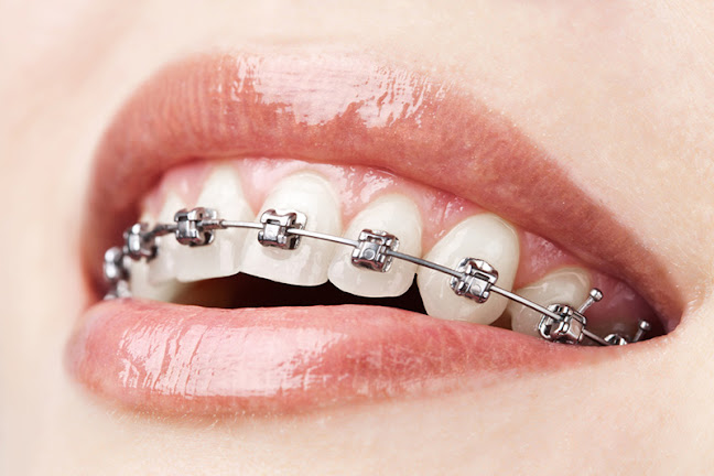 Teeth-in-Line Orthodontics - Milton Keynes