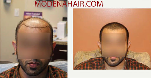 Modena Hair Transplant Institute image