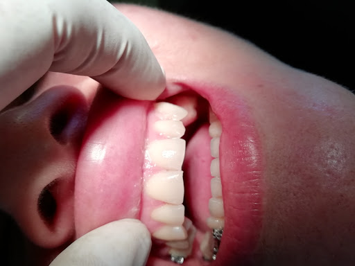 Clini-Dental