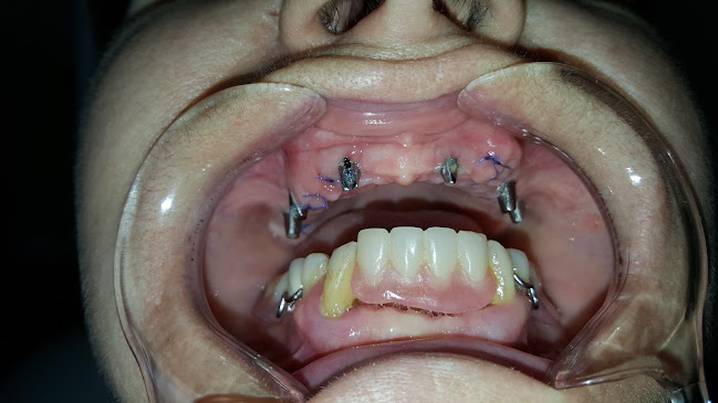 Opinii despre Clinica ImplantFix în <nil> - Dentist