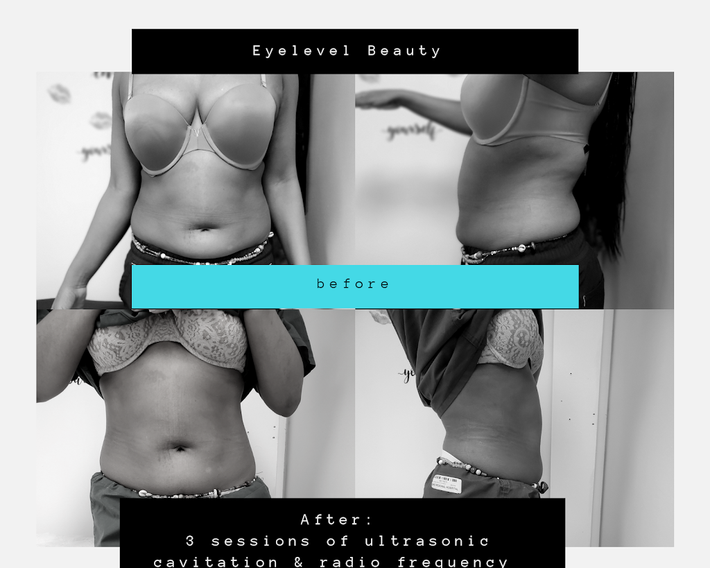 Eyelevel Beauty 27701