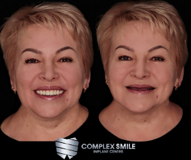 Complex Smile implant centre