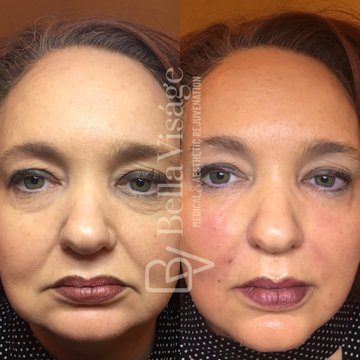 Explore wrap tattoo ideas, creative tattoo ideas in Lakeland, available at Bella Visge Medical & Aesthetic Rejuvenation