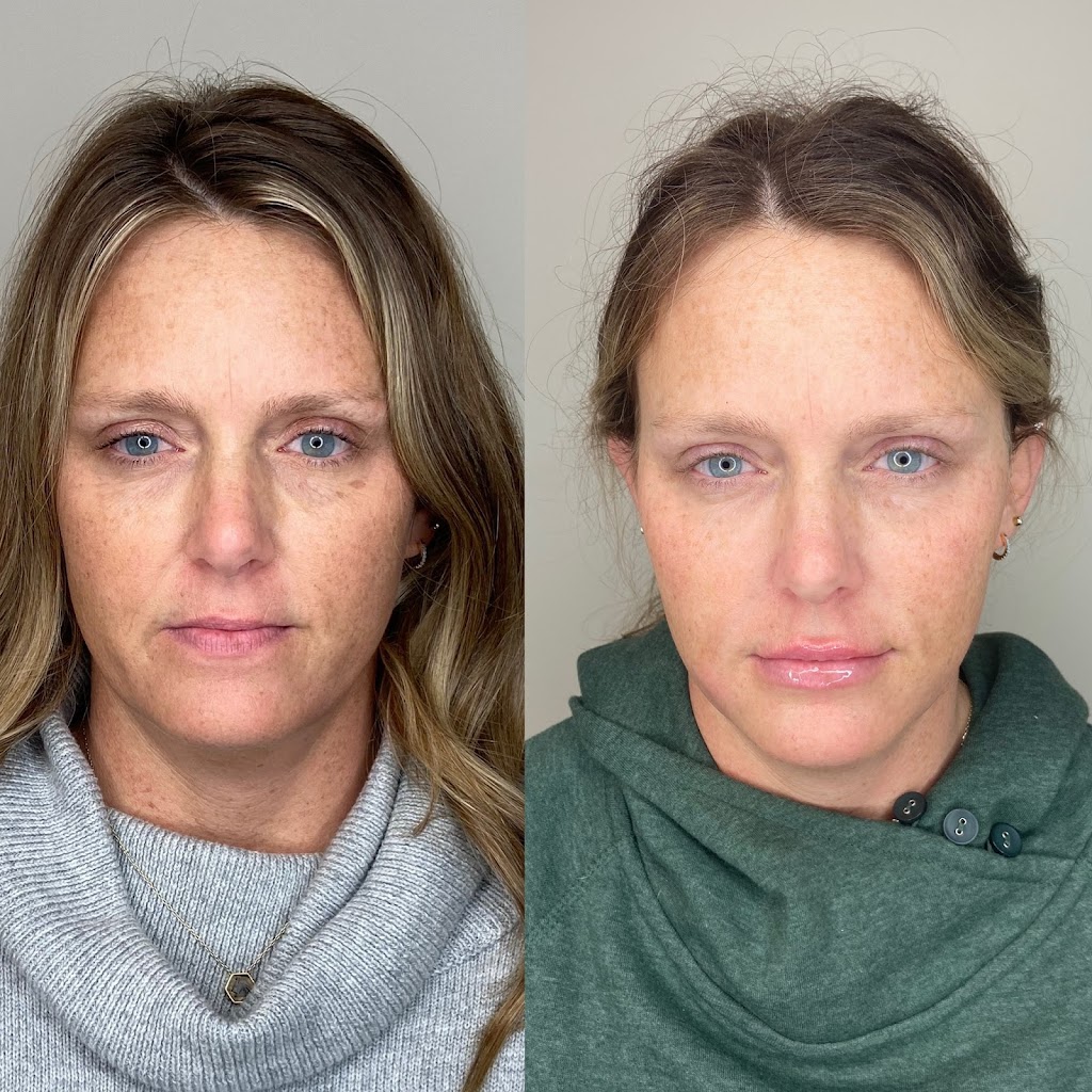 Amanda Ruyle-Ryan ANP Aesthetics 62704