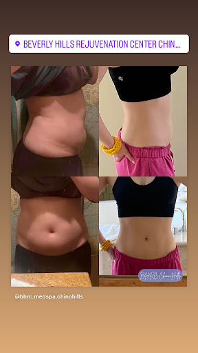 Beverly Hills Rejuvenation Center image
