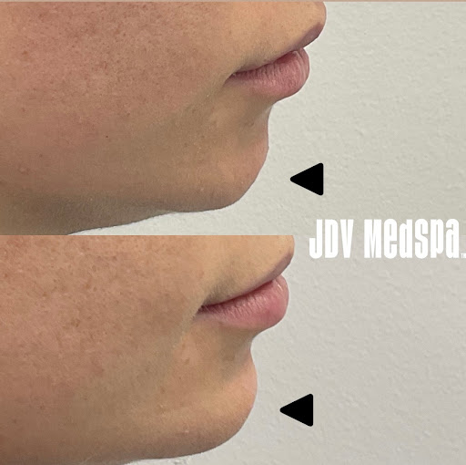 Explore nomad tattoo ideas, creative tattoo ideas in Canton, available at JDV Med Spa