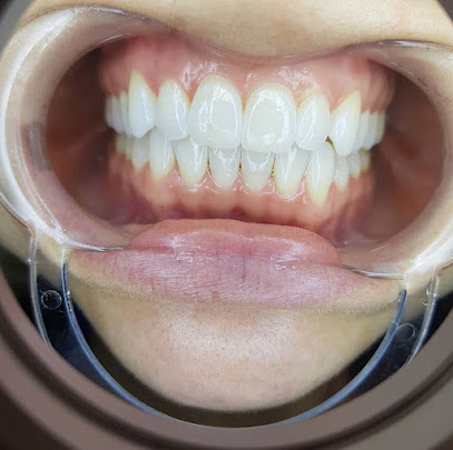 Ottawa Teeth Whitening