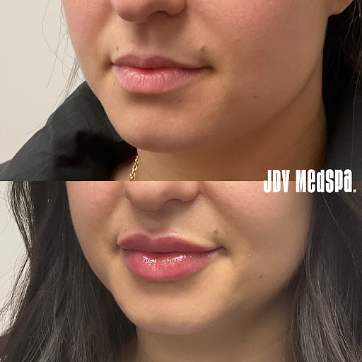 Explore wedding finger tattoo ideas, creative tattoo ideas in Canton, available at JDV Med Spa