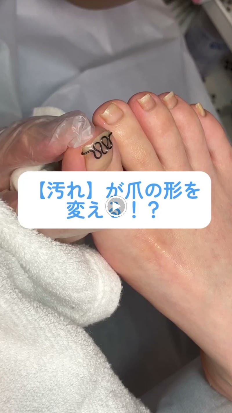 ANNYO【あんよ】/足の角質除去＆巻き爪矯正専門店/長野県伊那市