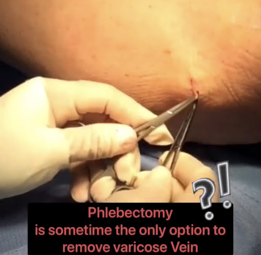 Explore tattoo ideas for lesbian couples, creative tattoo ideas in Lake Oswego, available at Lake Oswego Vein and Aesthetic LOVA