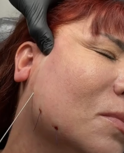 Medical Spa «Lavender Med Spa», reviews and photos, 3675 Crestwood Pkwy #400, Duluth, GA 30096, USA