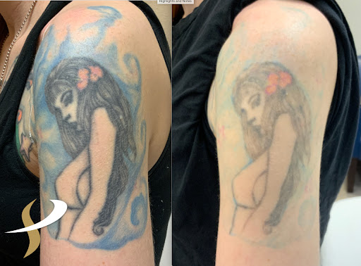 Explore borderline personality disorder tattoo ideas, creative tattoo ideas in Spokane, available at Premier Body and Laser