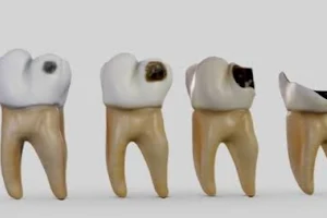 Ultra Smile Dental Care image